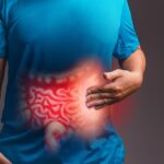 câncer de intestino