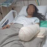 mulher grávida amputada RJ