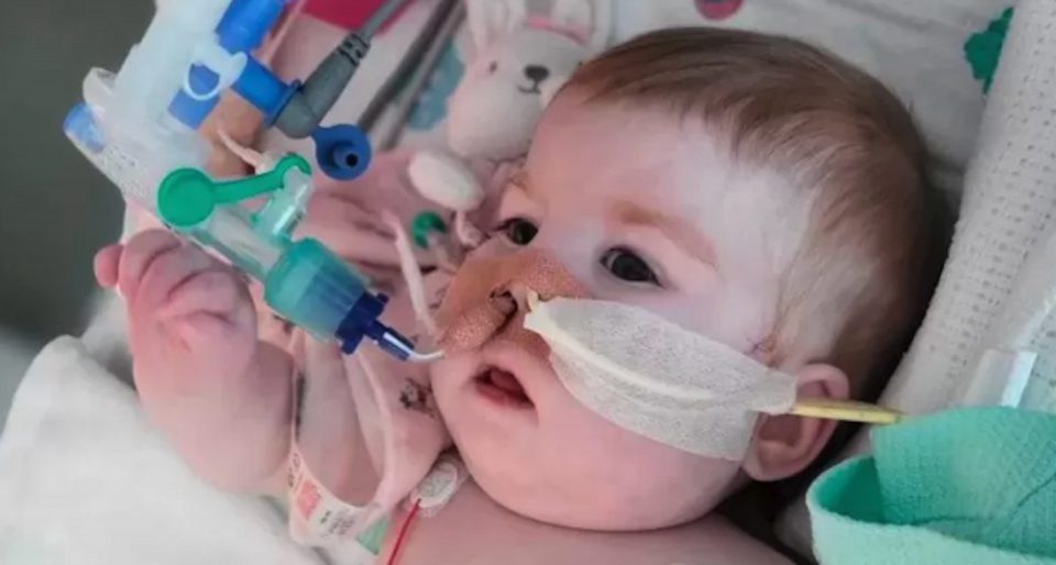 Bebê com doença grave morre após aparelhos desligados em batalha legal