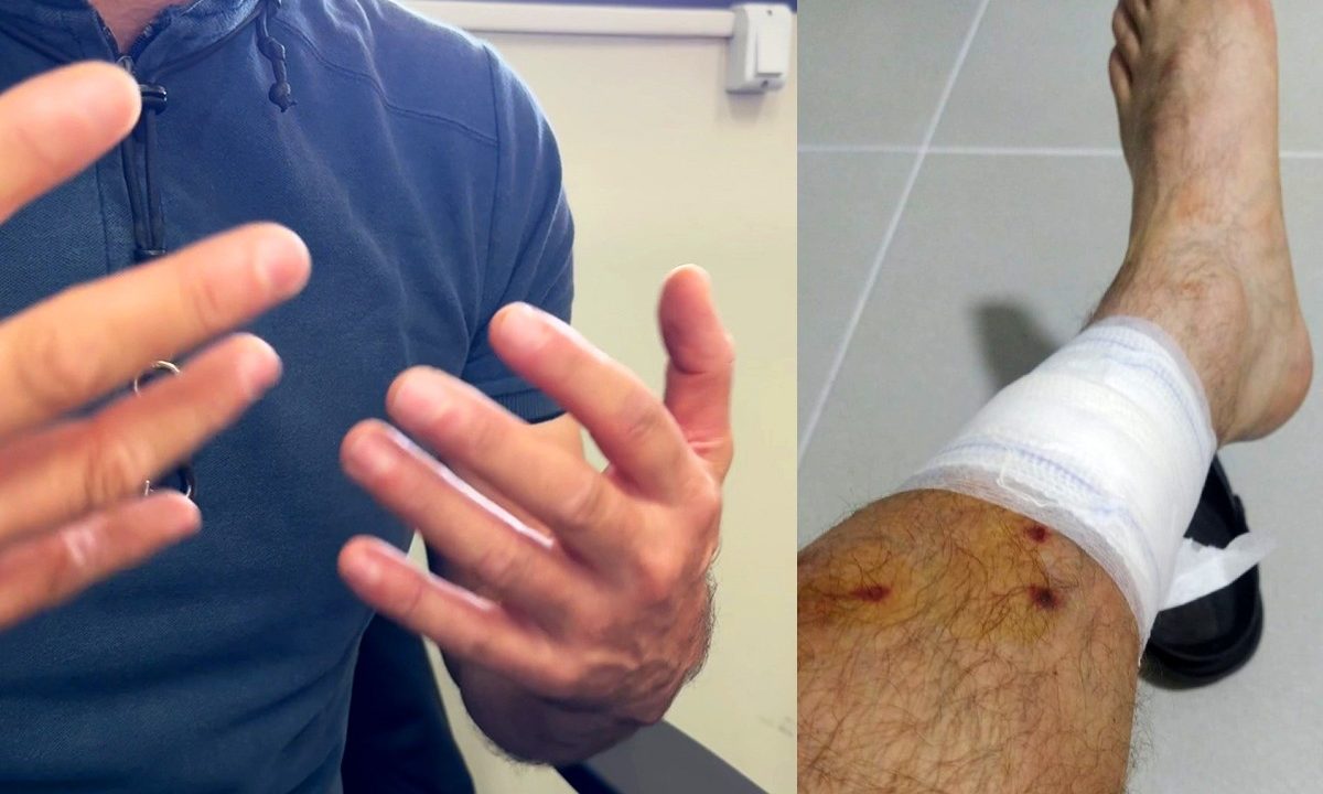 cobrador-ferido-alto-boqueirao-1