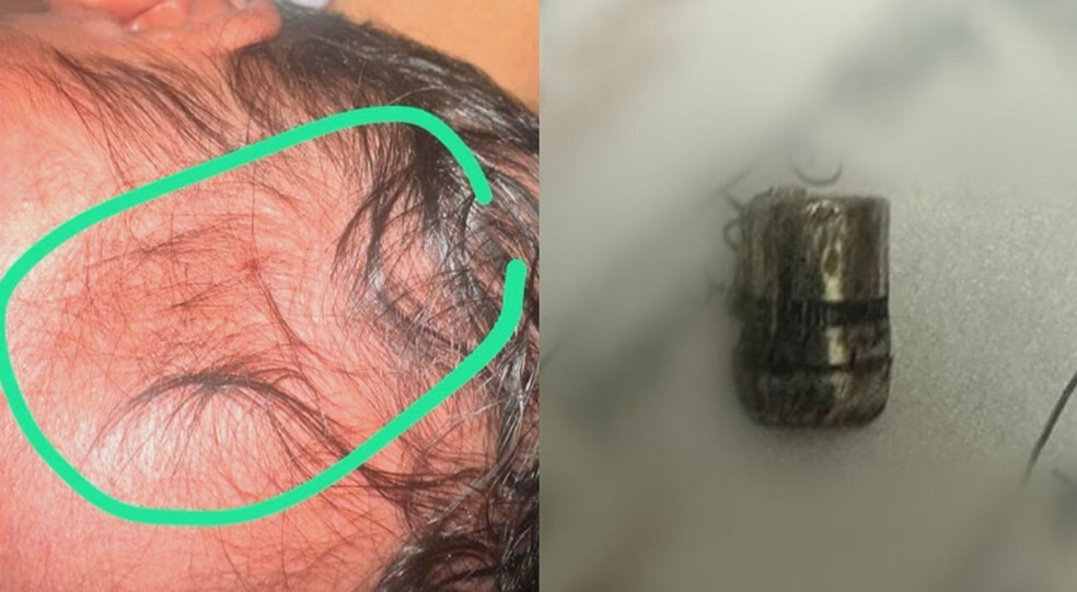 bebe-atingida-por-bala-perdida