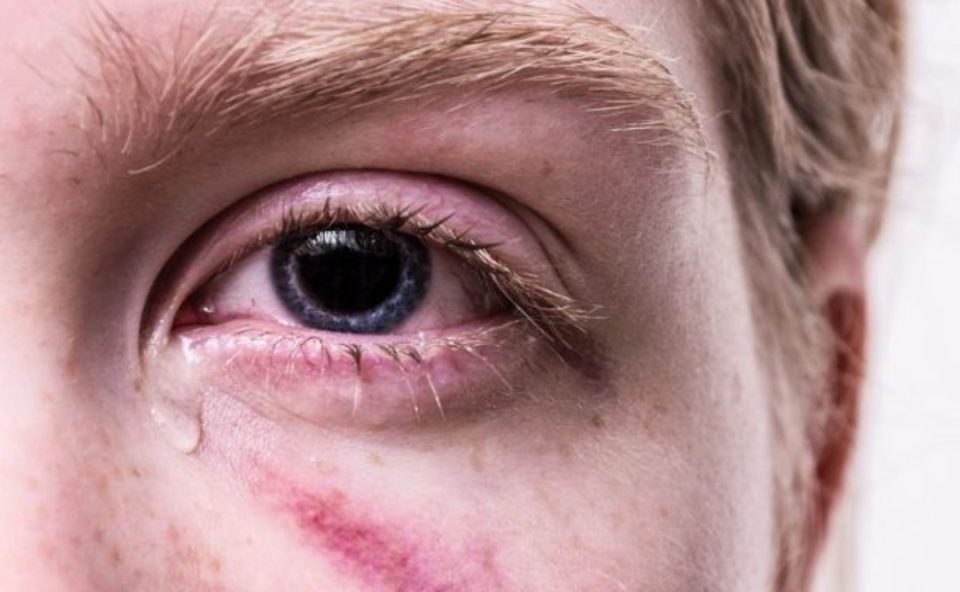 violencia contra mulher (1)
