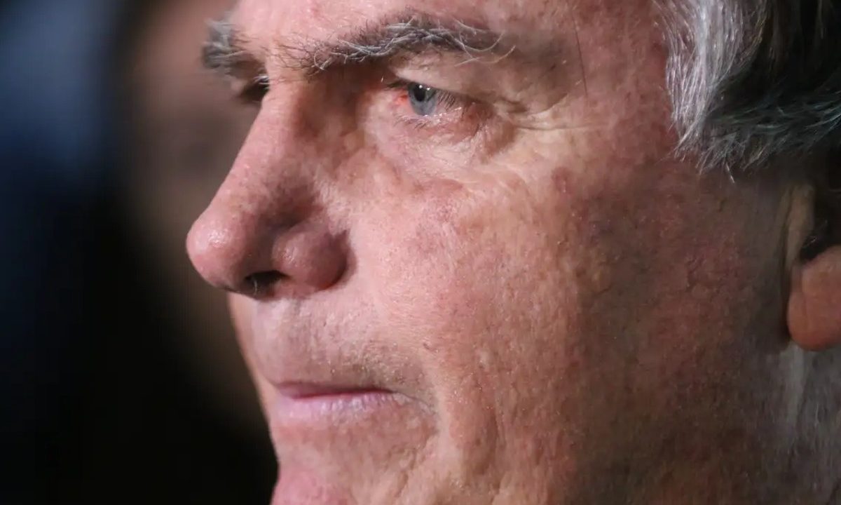 bolsonaro-caiu-andar-traumatismo-leve