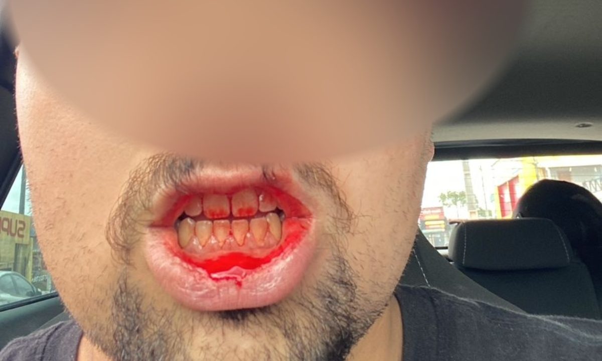 homem-agredido-polemica-loja-carro