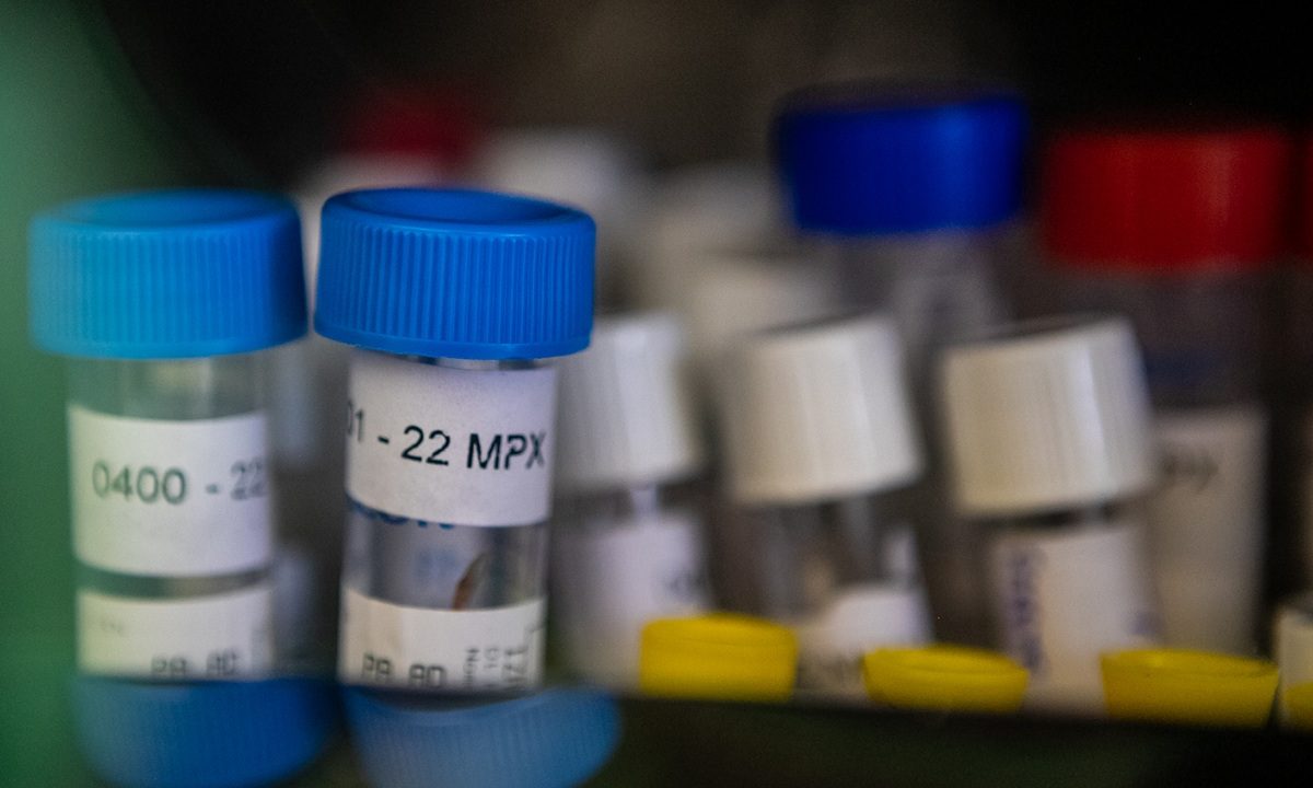 Paraná tem primeiro caso de MonkeyPox confirmado em 2026