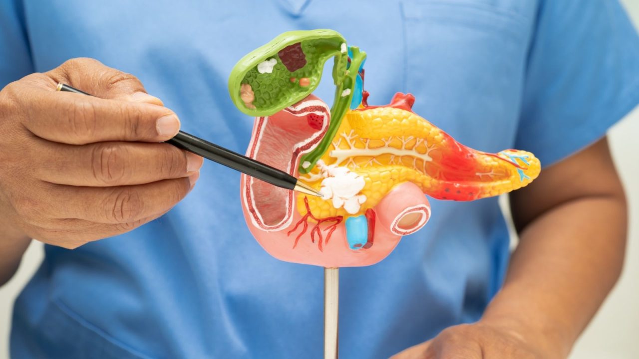 O que é pancreatite? Entenda sintomas, causas da doença e saiba quando procurar ajuda