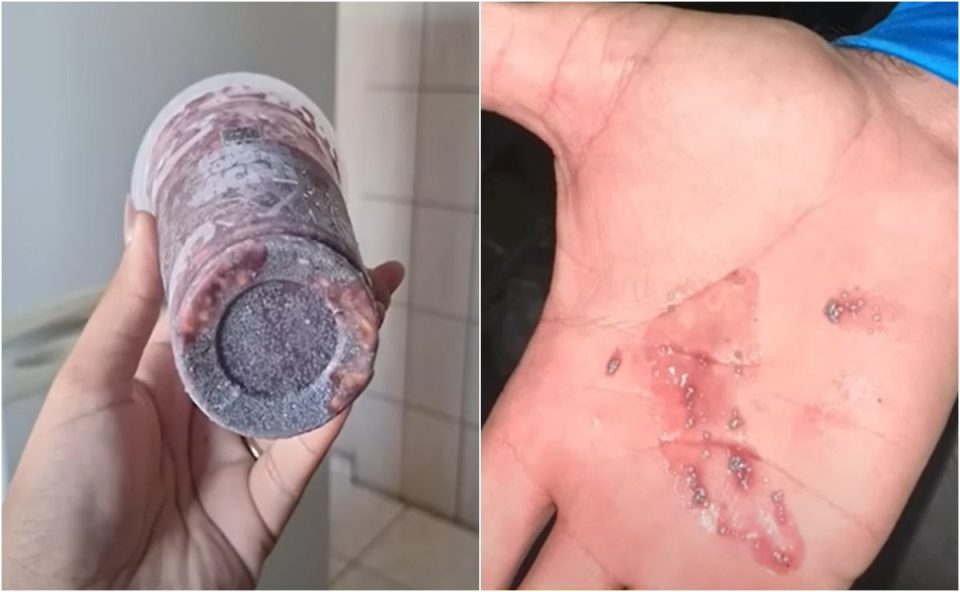 Imagem mostra copo de açaí e substância encontrada no produto, que foi confirmada como chumbinho pela perícia