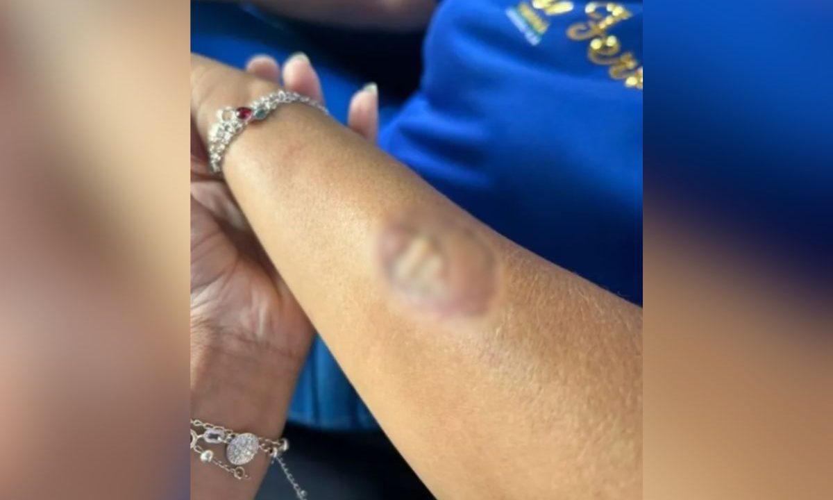 foto do baraço da diretora após a mãe do aluno agredir funcionárias em colégio