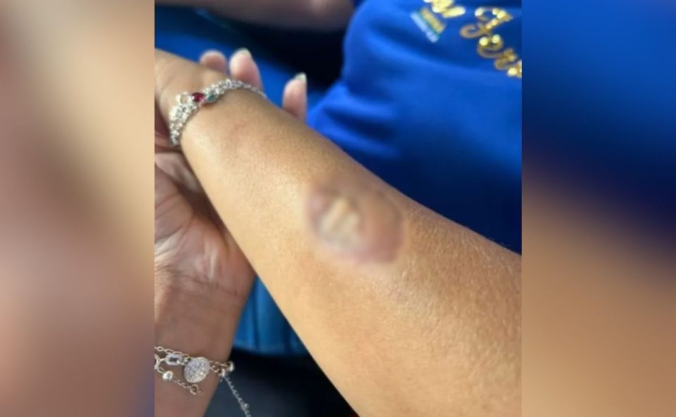 foto do baraço da diretora após a mãe do aluno agredir funcionárias em colégio