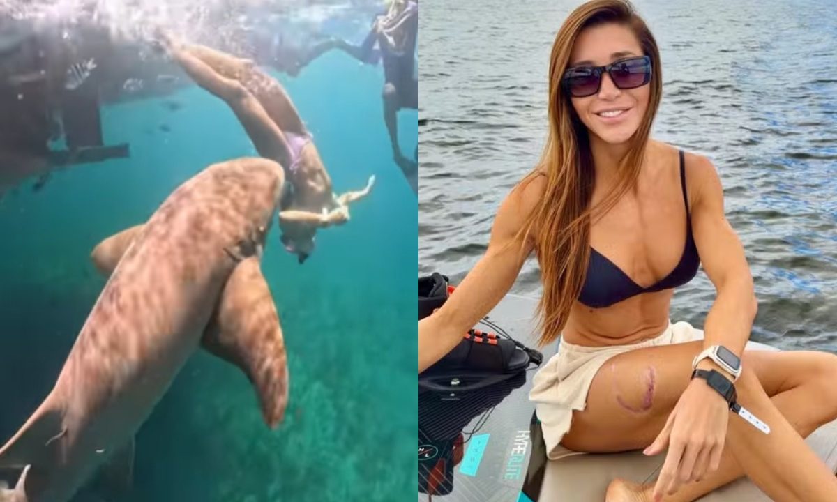 Foto do momento em que tubarão morde perna de advogada e foto da mulher depois do ataque em fernando de noronha