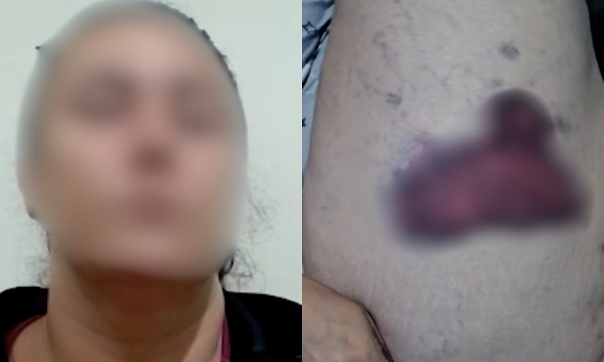 Foto da professora que matou o marido em Londrina, e do machucado que ela alega ter sido feito por ele.