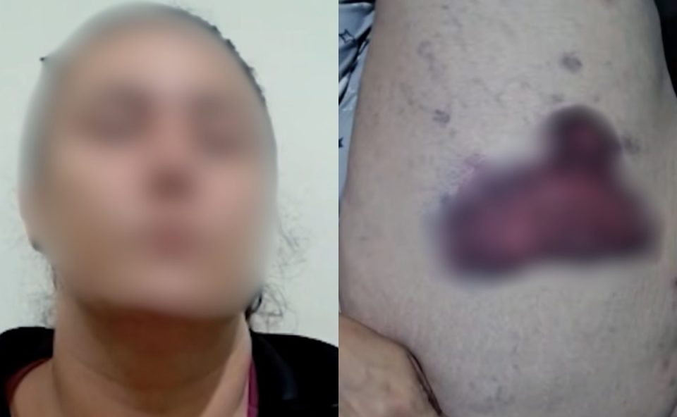 Foto da professora que matou o marido em Londrina, e do machucado que ela alega ter sido feito por ele.