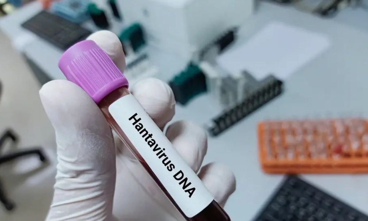Pessoa segurando frasco de sangue com hantavírus; morte foi registrada no Brasil